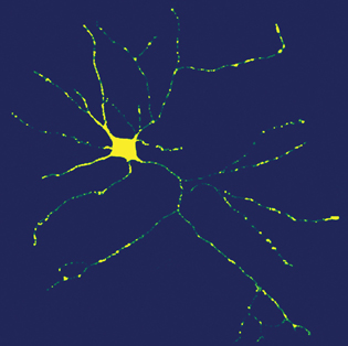 תא עצב מאזור ההיפוקמפוס בתרבית. הצבע הצהוב ממפה את מיקומהם של החלבונים אימפורטין-אלפא ואימפורטין-בטא. אפשר לראות שחלבונים אלה מצויים לא רק בגוף התא, אלא גם בשלוחות (דנדריטים) ובאקסון